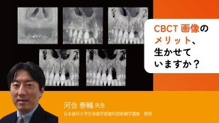 パノラマX線写真による骨粗鬆症スクリーニング法 : Teeth Tell Ta… 歯科パノラマX線画像による骨粗鬆症スクリーニング | メディア
